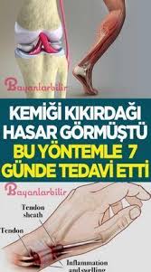 Kemik Panosundaki Pin