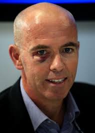 Daily Echo's Rob Merrick caught by stray elbow of Labour's Ed Balls in  annual football match