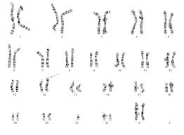 Chromosomenanalysen Allgemeine Informationen Dna Diagnostik Hamburg Gemeinschaftspraxis Fur Humangenetik Und Genetische Labore