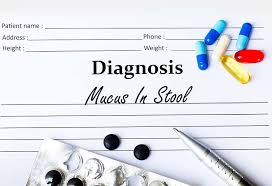 Mucus In Poop During Pregnancy Reasons Signs Treatment