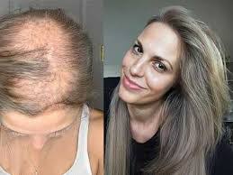 Lora Michaud's Instagram, Twitter & Facebook