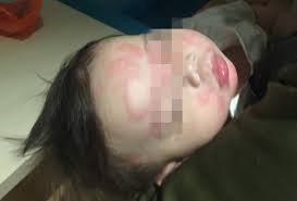 Jika anda pernah mengalami berak berdarah, anda pasti tahu berasa risaunya diri ini sebaik nampak. Syak Susu Tiruan Ibu Terduduk Lihat Najis Anak Berdarah Astro Awani