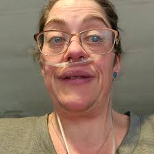 Life with rare PAH and medical research experience