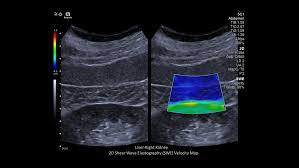 Cortex robotics sdn bhd is another related company of cortex imaging sdn bhd, which specialized in aoi solution and machine vision for various industries sector including semiconductor, automotive, medical, and electronics. Acuson Sequoia Ultrasound System