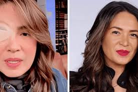 Qué está pasando con Donald Trump y su discurso de género? Ángel Candia nos  contó