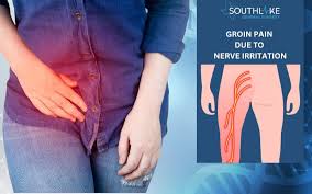 Image result for sore skin in the groin area