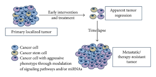 Doctors typically classify recurrent cancers by how much they spread and where they crop up: Pathways To Breast Cancer Recurrence