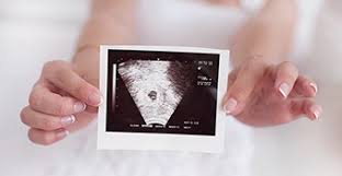 bejelentése babavárás képek ingyen