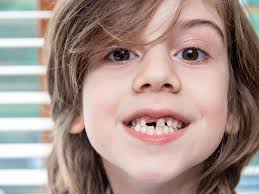 Dental Care Childrens Teeth 5 8 Years Raising Children