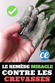 Epingle Sur Remedes Naturels