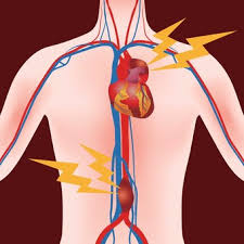 Los síntomas incluyen dolor en la parte inferior de la espalda, hinchazón abdominal, náuseas, vómitos, frecuencia cardíaca rápida. Aneurisma De Aorta Abdominal Por Que Es Clave Detectarlo