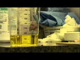 Image result for Urine Output