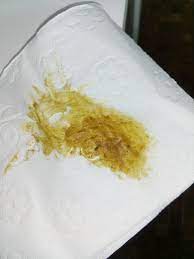 Ursachen von gelben schleim in den hund ' s hocker. Ist Das Gelber Stuhlgang Achtung Eklig Gesundheit Krebs