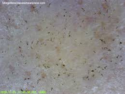 The black specks caused by feline acne can be difficult to distinguish from flea excrement, but their localization under the chin will suggest acne. Hund Looking For How To Whitening Your Skin Fast