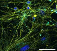 Hier sichtbar sind anhäufungen von synapsen mit glutamatrezeptoren, zu erkennen als helle punkte. Chemotherapie Verwirrung In Der Nervenzelle Friedrich Alexander Universitat Erlangen Nurnberg