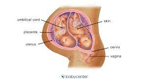 Linz1234 has shared photos of her bump throughout this pregnancy. Fraternal Twins In The Womb 36 Weeks Babycenter
