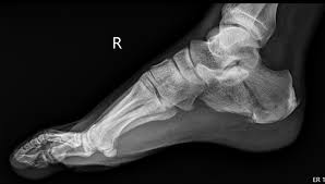 SplintER Series: We've Got A Jumper