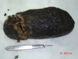 Learn about the causes, symptoms, and treatment options for this condition today. Https Ispub Com Ijs 6 2 12278
