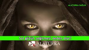 Sol Gozun Segirmesi Neden Olur