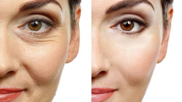 Anti wrinkle treatment product image