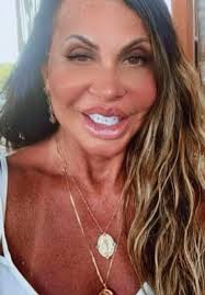 Gretchen quase 70 anos rostinho de 20 😊 vídeo comprova ⤵️