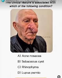 Instagram photo by BAK CIU 2MELAN KARET CRINTON ANUS TAPI LIPO USIR HK AHO  KIA bU$i • Apr 20, 2025 at 12:51 AM