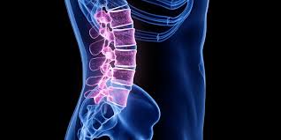 Image result for Spinal Trauma