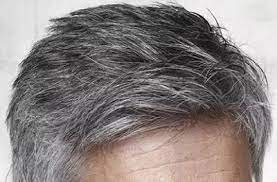 Uzm Dr Hakan Buzoglu Dermatoloji Uzmani