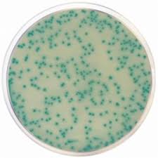 The sample is sent to a lab where it's placed in a dish of nutrients that encourage bacterial growth. Mrsa Chromogenic Agar Base Formato 500 G