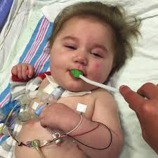 Rett Syndrome Externally-Led Patient-Focused Drug Development Meeting