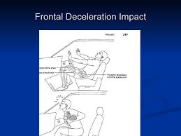 Learn the definition of 'dashboard injury'. Trauma And Mechanism Of Injuries