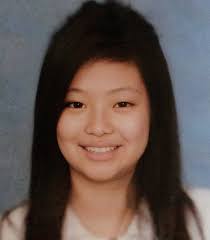 What kind of plastic surgeries did Kim Jennie do? Can I have a detailed  analysis?