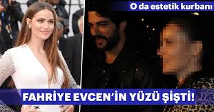 Fahriye evcen burun estetiği oldu mu? Fahriye Evcen Yanaklarina Dolgu Yaptirinca Yuzu Sisti Son Dakika Magazin Haberleri