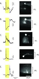 Cabinet organisation for less, at your doorstep faster than ever! Recording Light Evoked Postsynaptic Responses In Neurons In Dark Adapted Mouse Retinal Slice Preparations Using Patch Clamp Techniques Protocol