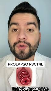 Understanding Prolapso Rectal: Causes, Symptoms, and Treatment