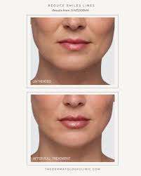 The Dermatology Clinic(@the_dermatology_clinic) • Instagram 사진 및 동영상