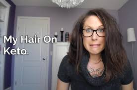 What Happened To My Hair On Keto Keto Hair Loss Keto Rash Hair Nutrition