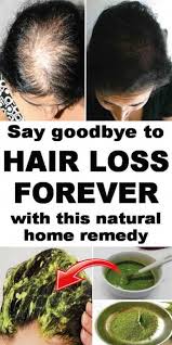 That's important because vitamin e has antioxidant properties and it repairs damaged hair follicles. The Best Home Remedy To Stop Hair Fall Forever Hairloss Hairfall Hairlossgoaway Hair Fall Remedy Home Hair Loss Remedies Hair Fall Remedy