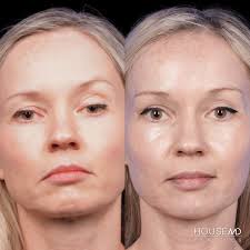 Reliable Facial Plastic Surgery San Francisco Bay Area
