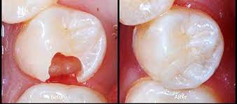 Pin On Dental Health