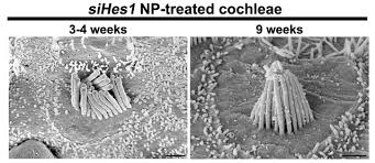 These observations suggest that the movement of stereocilia and the resulting modulation of their ionic currents is likely to be greater for outer hair cells. Rna Injection Restores Hearing In Guinea Pigs The Scientist Magazine