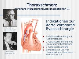 This is wenn der chirurg ran muss: Prof Dr Dr V Doring Universitares Herzzentrum Hamburg Ppt Video Online Herunterladen