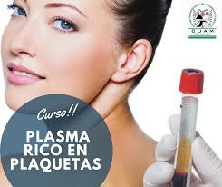 💆‍♀💆‍♂ PLASMA RICO EN PLAQUETAS 💆‍♀💆‍♂ 🔈🔈 CURSO INTENSIVO 🔈🔈 Centro  Universitario de Alternativas Médicas Sede Culiacán 📆Se llevará a cabo el  próximo 8 y 9 de Junio 📍Calle Naranjos 1957. Col.