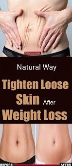 Loose stomach skin can also be just excess subcutaneous body fat that's right underneath your skin. What Does Saggy Stomach Tighten Mean Healthy Medicine Tips Tighten Loose Skin Loose Skin Saggy Stomach Skin