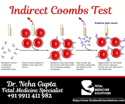 Image result for Indirect Coombs