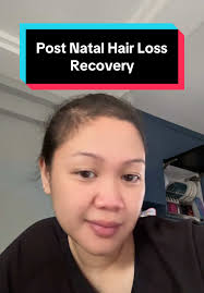 So many mums dmed and commented asking about how I grew back my hair! Here  is my secret! No gatekeeping! Check my beacons💕🔗