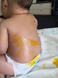 Normal ke najis bayi warna hijau. Warna Najis Bayi Dan Bila Mama Perlu Risau Kenali 6 Jenis Najis Bayi
