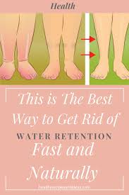 Exercise helps to reduce water retention by moving fluids around the body and excreting salt through sweat. Pin On Water Retention Remedies