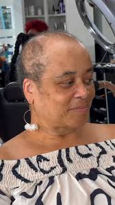 ♥️Balding is not just a physical change; it’s an emotional journey that  many women Silently Endure🫂... It’s waking up each day with a mix of hope  and fear, hoping for a solution and fearing judgment ...