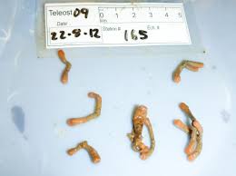 Image result for thin ribbon stools human poop